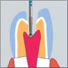 schéma démonstratif - K802L.314.021