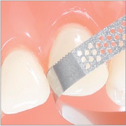 strips diamantés perforés - représentation