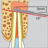 diamant chirurgie - D254 presentation