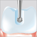CARBURE TUNGSTENE