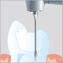 ENDODONTIE