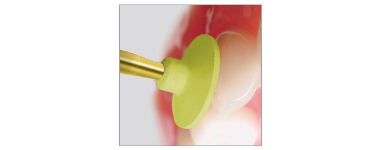 Polissage de composite