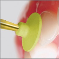 Polissage de composite