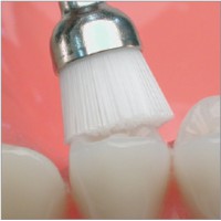 Polissage prophylactique