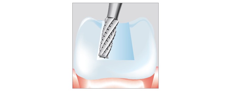Fraises - Solid carbide