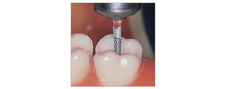 Instruments à finir