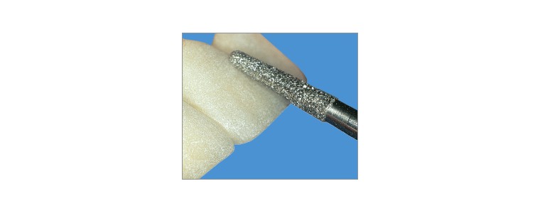 Diamants PM